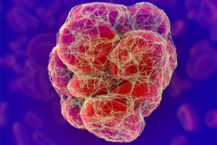 Fat-Dose Clot Prophylaxis for COVID-19 Tied to Mortality