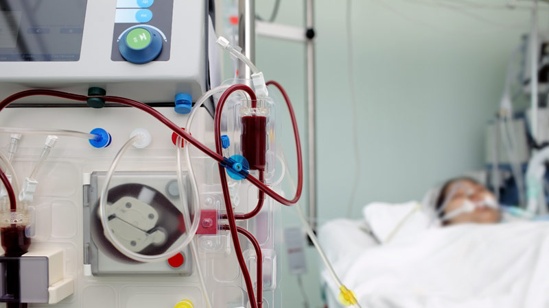 Early Dialysis in Serious Kidney Hurt Would now not Give a recall to Outcomes