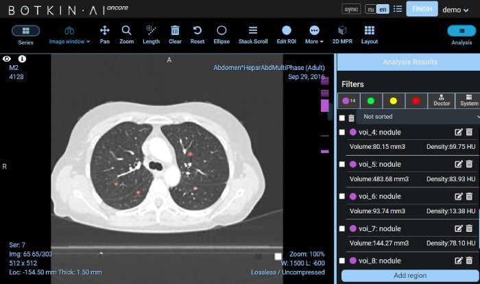 Moscow DOH makes use of AI platform to detect lung cancer signs