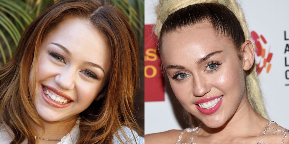 These Smartly-known person Smile Transformations Will Astound You