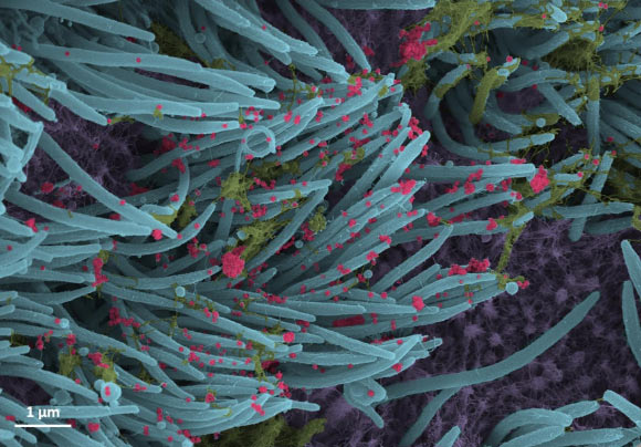 Scientist Captures Novel Images of SARS-CoV-2-Contaminated Cells