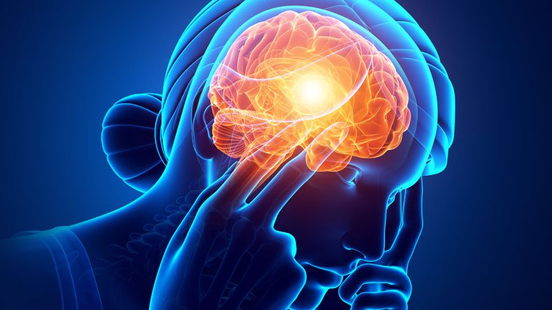 HIT-6 Helps Note ‘Meaningful Change’ in Persistent Migraine