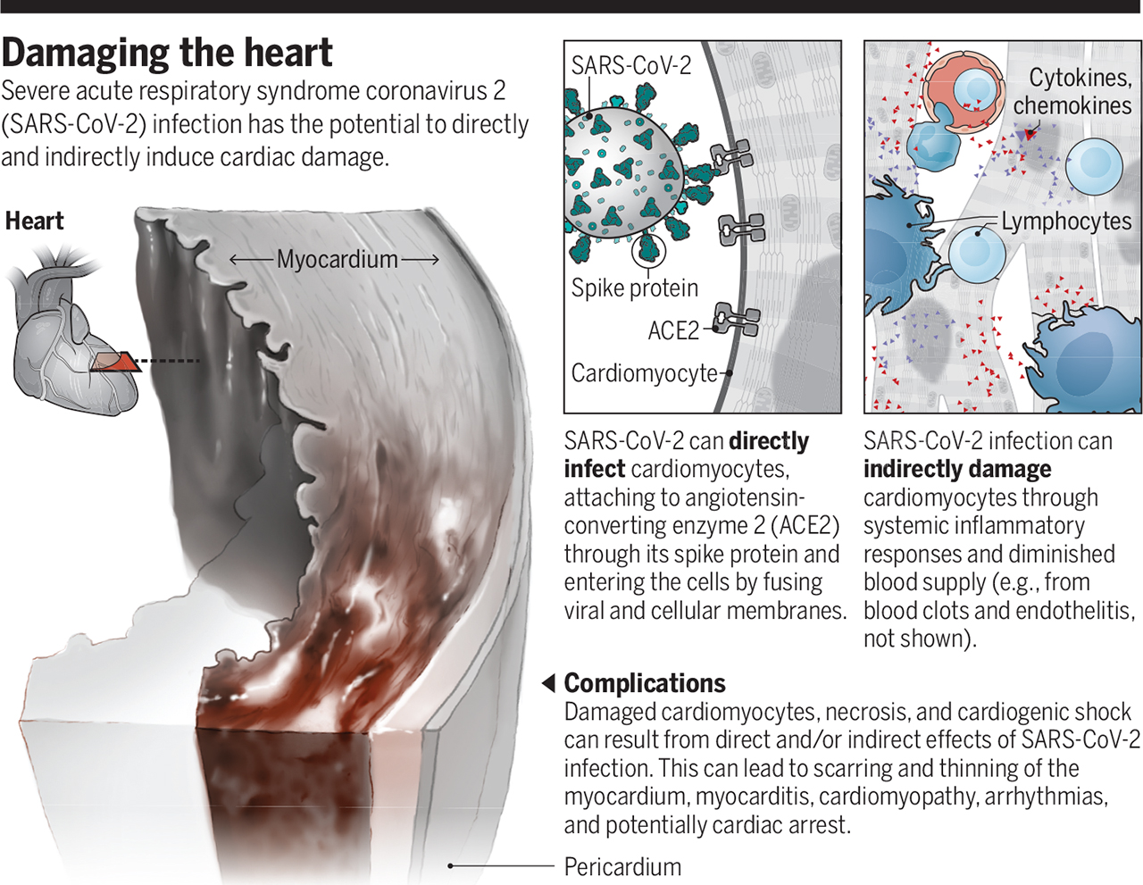 COVID-19 can occupy an impact on the coronary heart