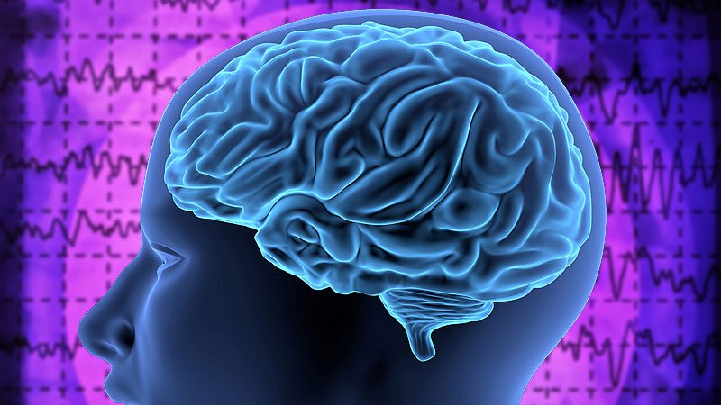 Gradual-Onset Epilepsy Tied to a Threefold Increased Dementia Threat