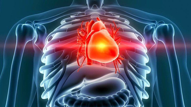 Clopidogrel Bests Ticagrelor for Non-mandatory PCI