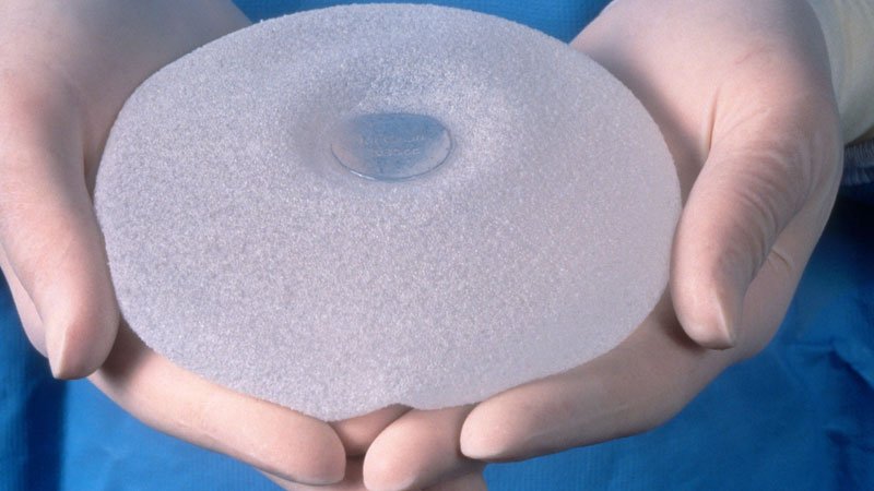 Textured Implants Linked to Worse Breast Most cancers Outcomes
