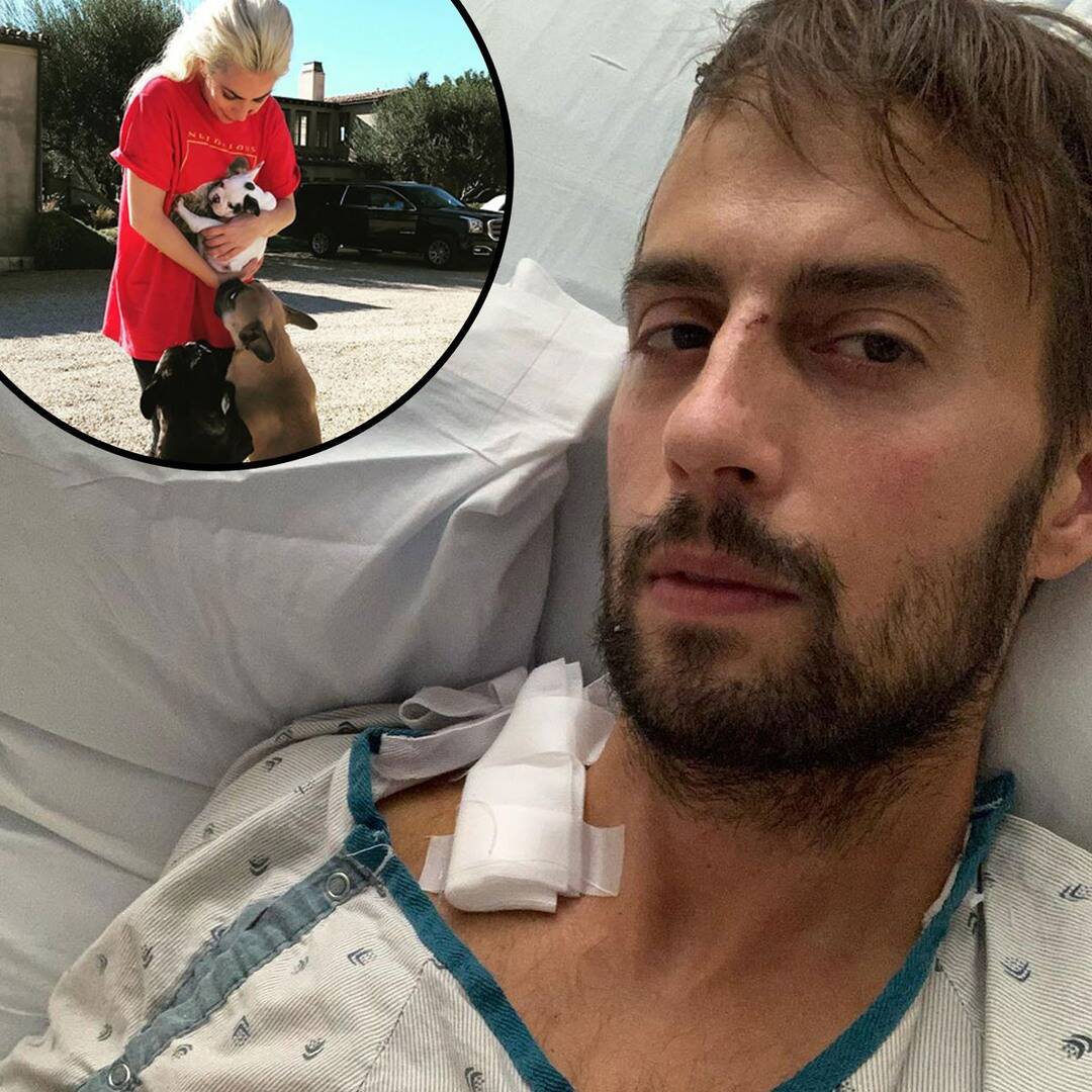 Woman Gaga’s Dog Walker Ryan Fischer Breaks Silence After “Very Shut Name With Demise”