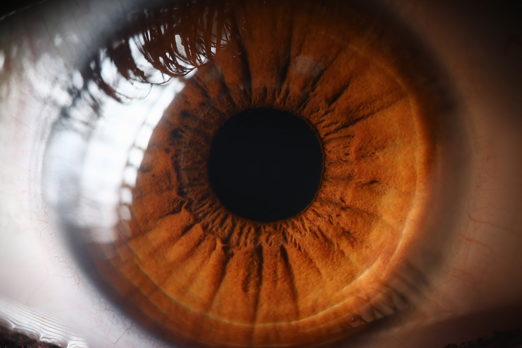 Your Eyes Can also Signal Your Menace for Stroke, Dementia