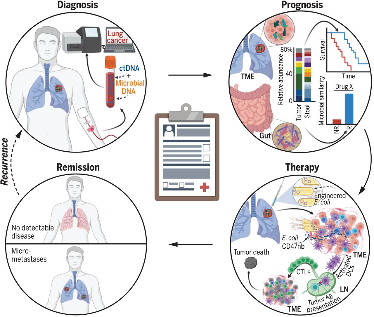 The microbiome and human most cancers