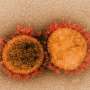 Fair appropriate fortune is required for any a hit coronavirus variant, look reveals