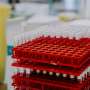 Gaze sheds extra light on price of rare blood clots after Oxford-AstraZeneca vaccine