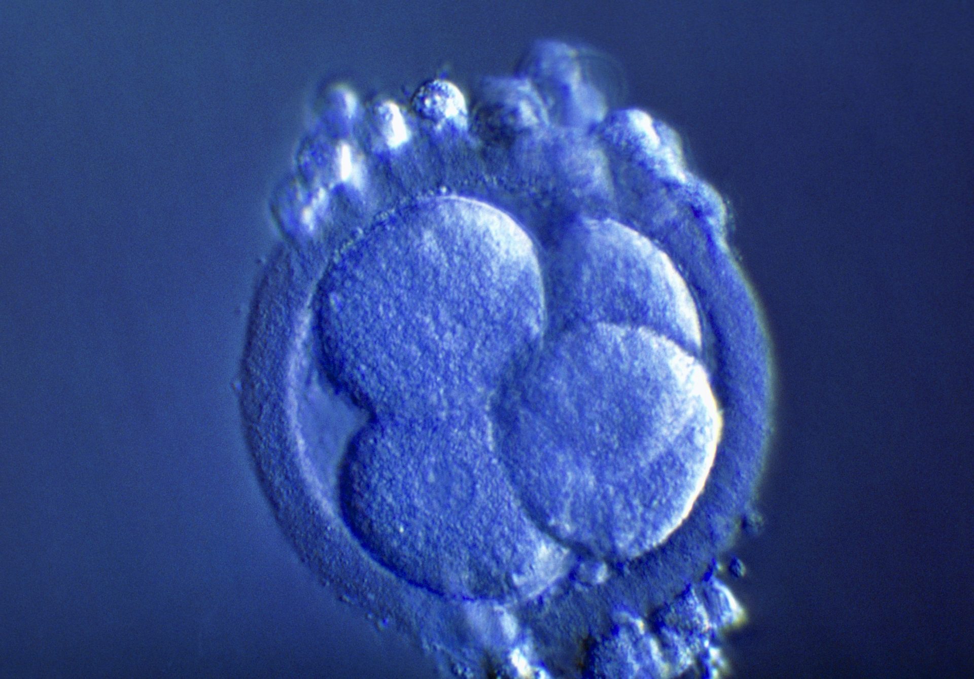 Restrict on Lab-grown Human Embryos Dropped by Stem Cell Physique