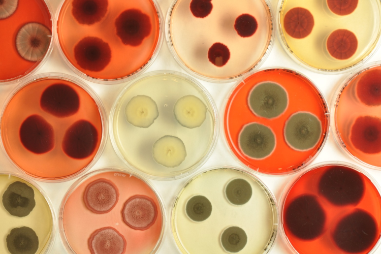 Chromologics: Precision fermentation addresses ‘main challenges’ going via natural colours