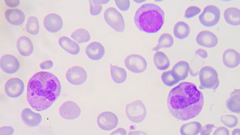 Luspatercept Relieve Additionally in Non-Transfusion-Dependent Thalassemia