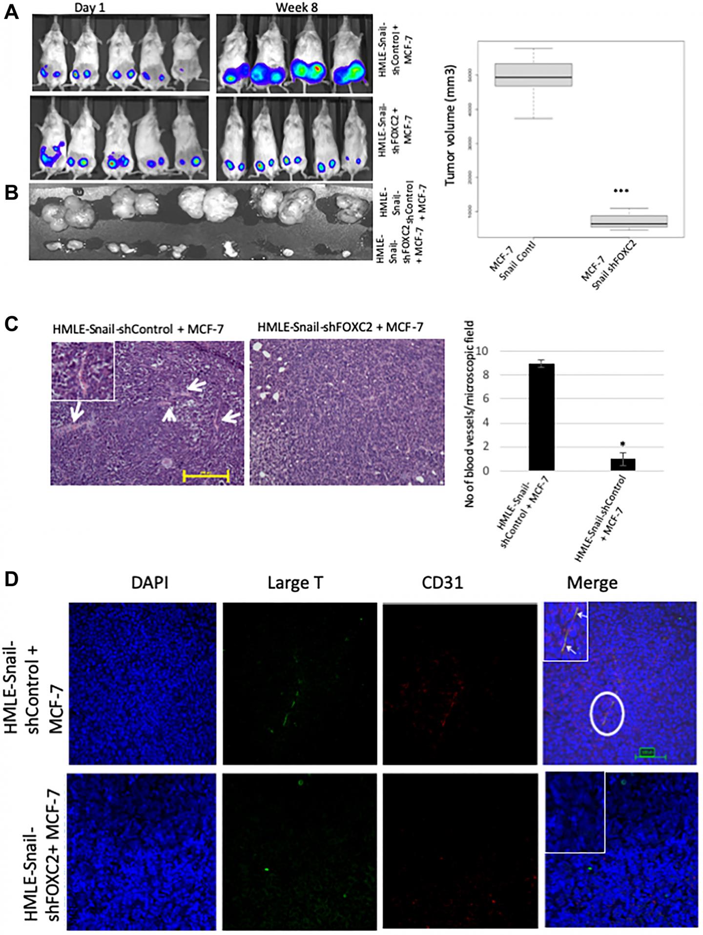 Oncotarget: Epithelial-mesenchymal transitions fabricate endothelial cells and tumor snort