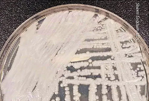 ‘Superbug’ Fungus Spreads Amongst Prone in Two U.S. Cities