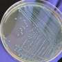 Food scientists possess national atlas for deadly listeria