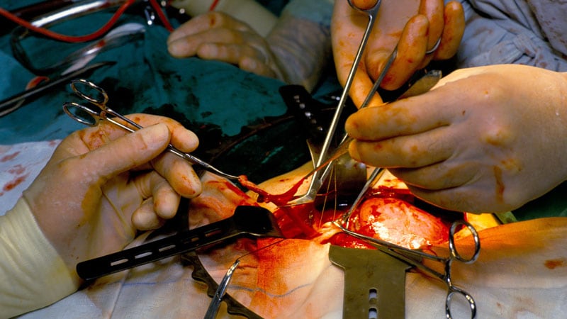 US Kidney Transplants Develop in Number and Success