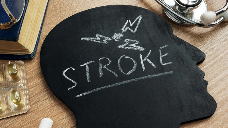 Ticagrelor of Acquire Clinical Earnings aAfter Stroke, TIA: THALES