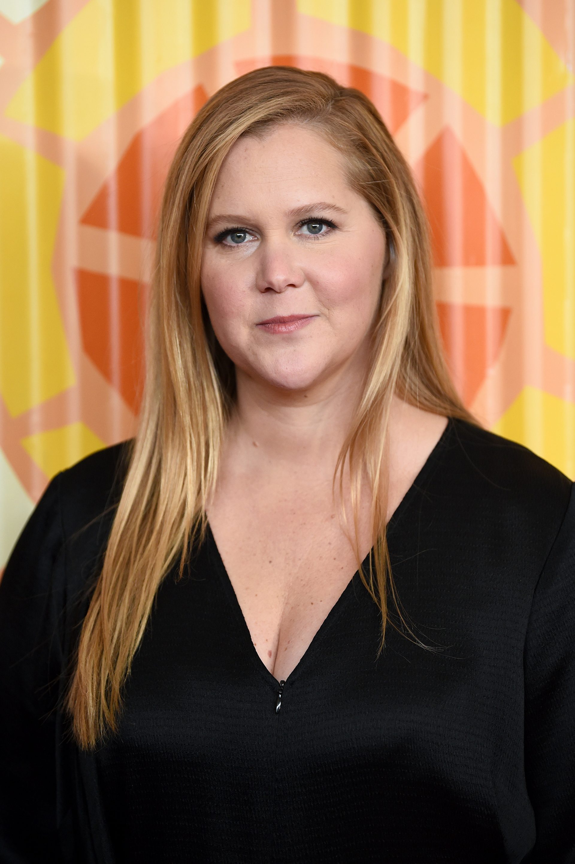 Amy Schumer Says Her Doctor Stumbled on ‘30 Spots of Endometriosis’ At some level of Her Hysterectomy