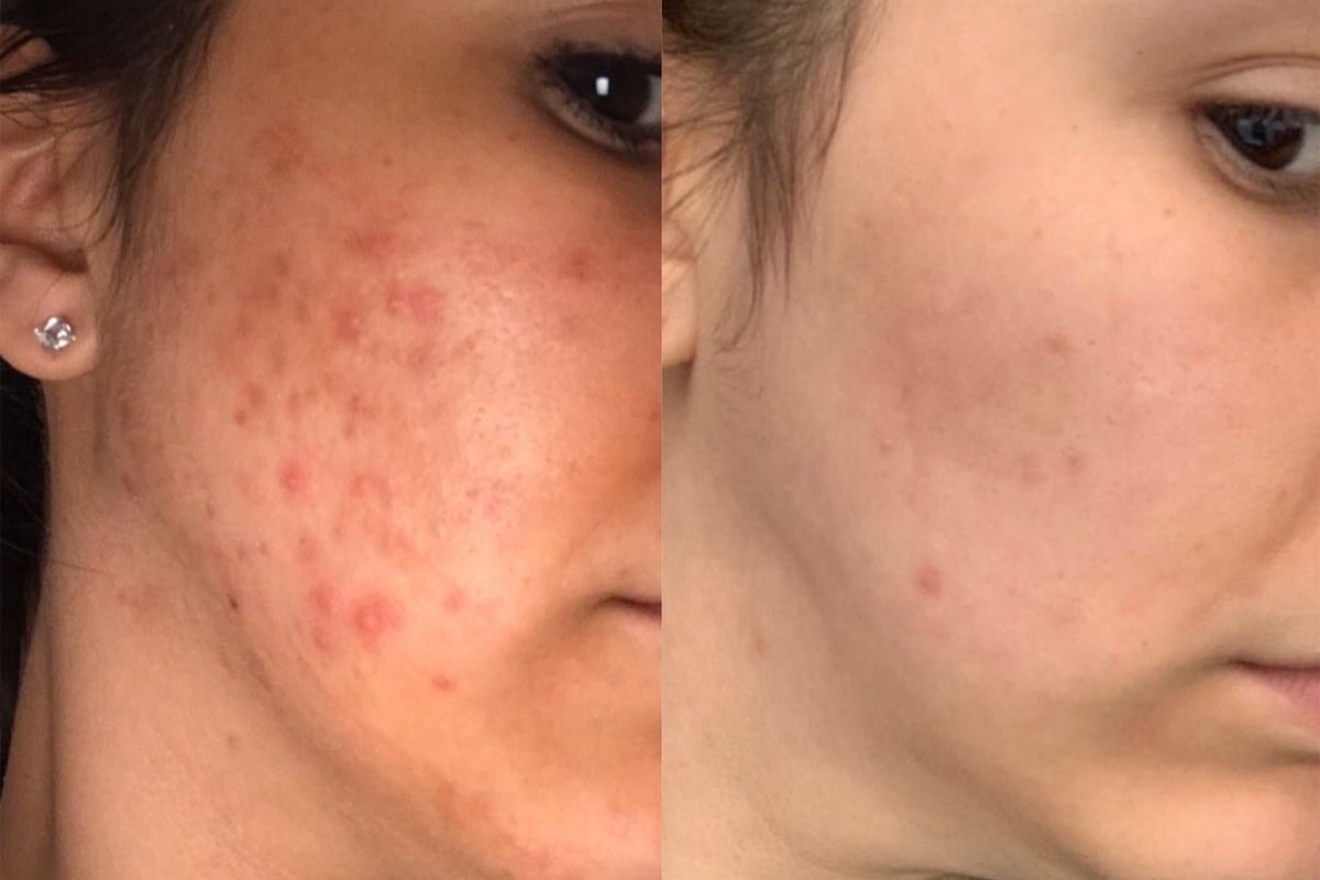 39 Skincare Products That Are Essentially A Reset Button For Your Face