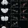 Brainstem pathway modulates misfortune in placebo operate
