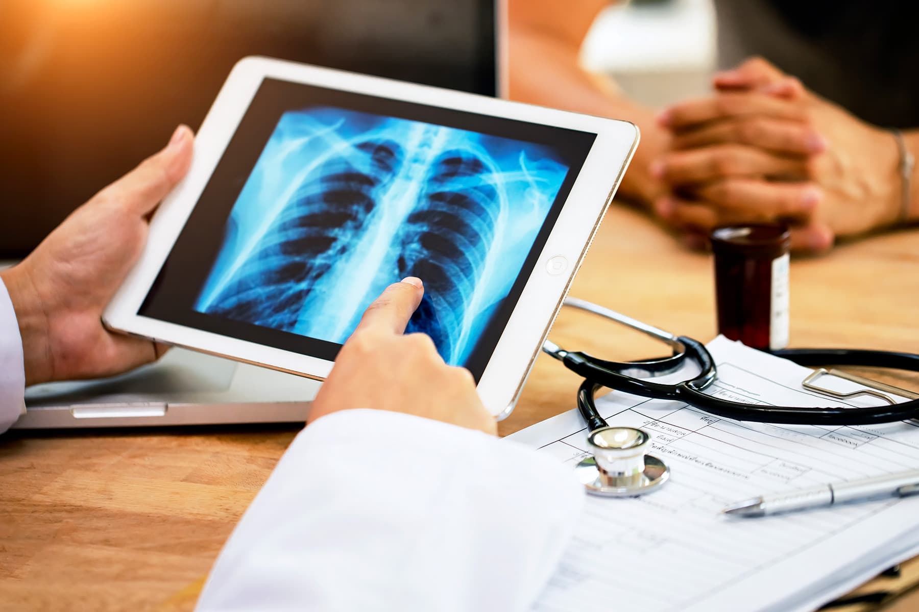 Targeted High-Dose Radiation Helps Wrestle Superior Lung Most cancers